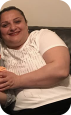 Before weight loss